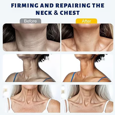 Roller Massage Neck Cream 🧴 Collagen & Hyaluronic Acid | Firms Neck, Reduces Wrinkles & Double Chin-JKL