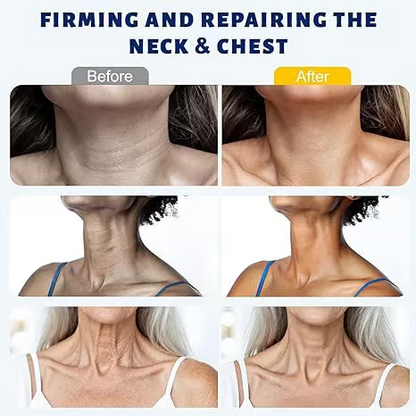 Roller Massage Neck Cream 🧴 Collagen & Hyaluronic Acid | Firms Neck, Reduces Wrinkles & Double Chin-JKL